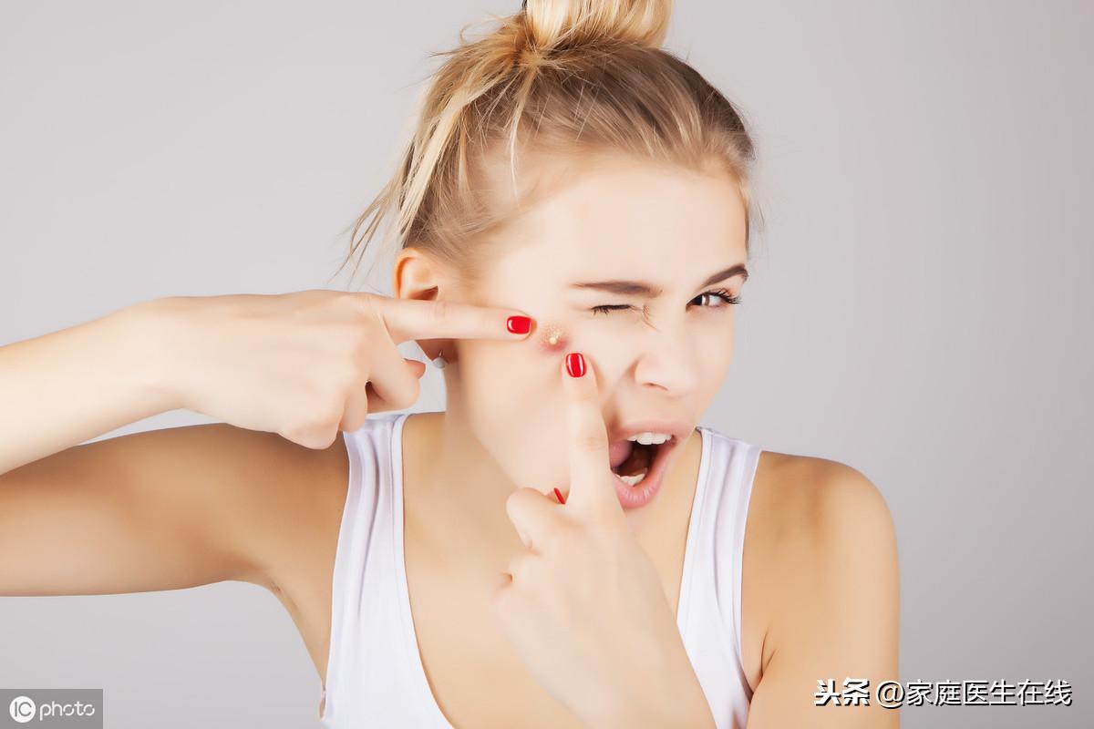 青春痘怎样消除，皮肤专家教你几招