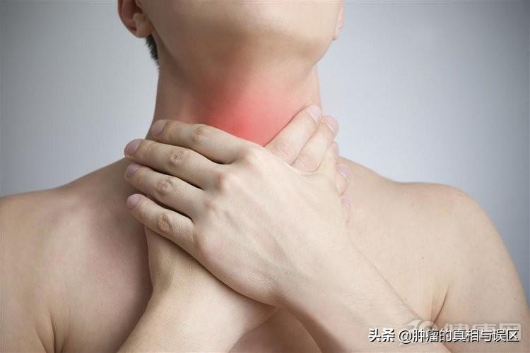 甲状腺癌症状，甲状腺癌的诱因