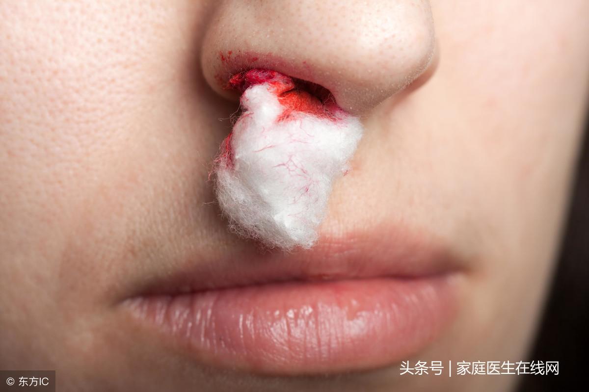 脑血栓的症状，出现这5种不适可能是脑血栓来临