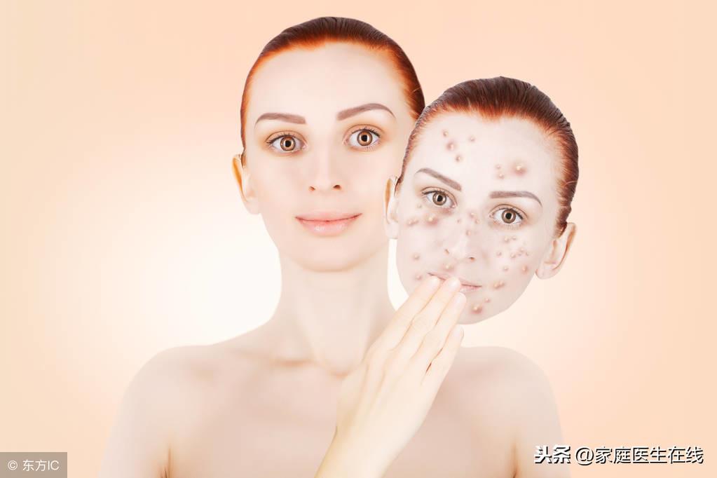 如何治疗色斑，4个好方法，帮你“对付”色斑！