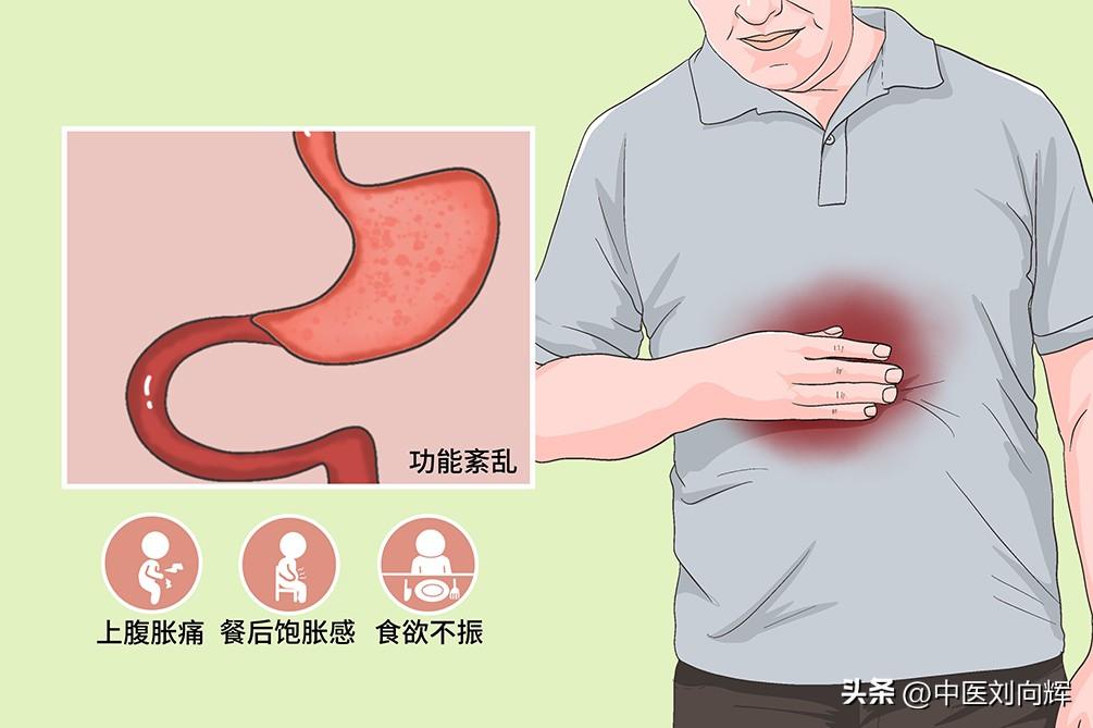 湿气重的表现，出现这三个表现就是湿气重