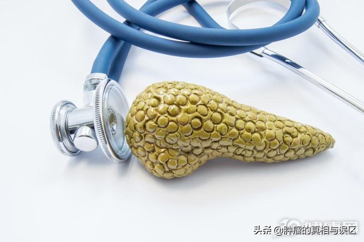 胰腺癌的症状，胰腺癌的几大病因要牢记
