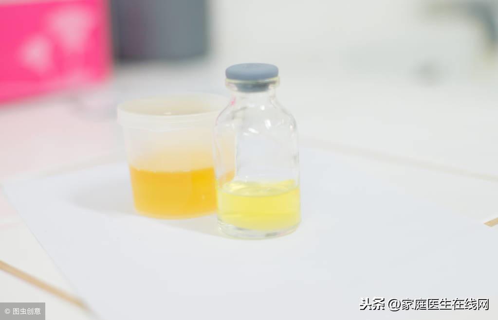 尿蛋白高是什么原因造成的，哪些症状表明得了蛋白尿？