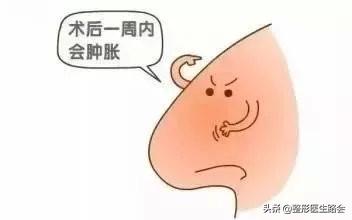 鼻子整形的后遗症，如何预防隆鼻整形后遗症