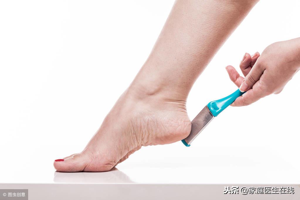 脚后跟干裂怎么办，这4个小妙招很管用