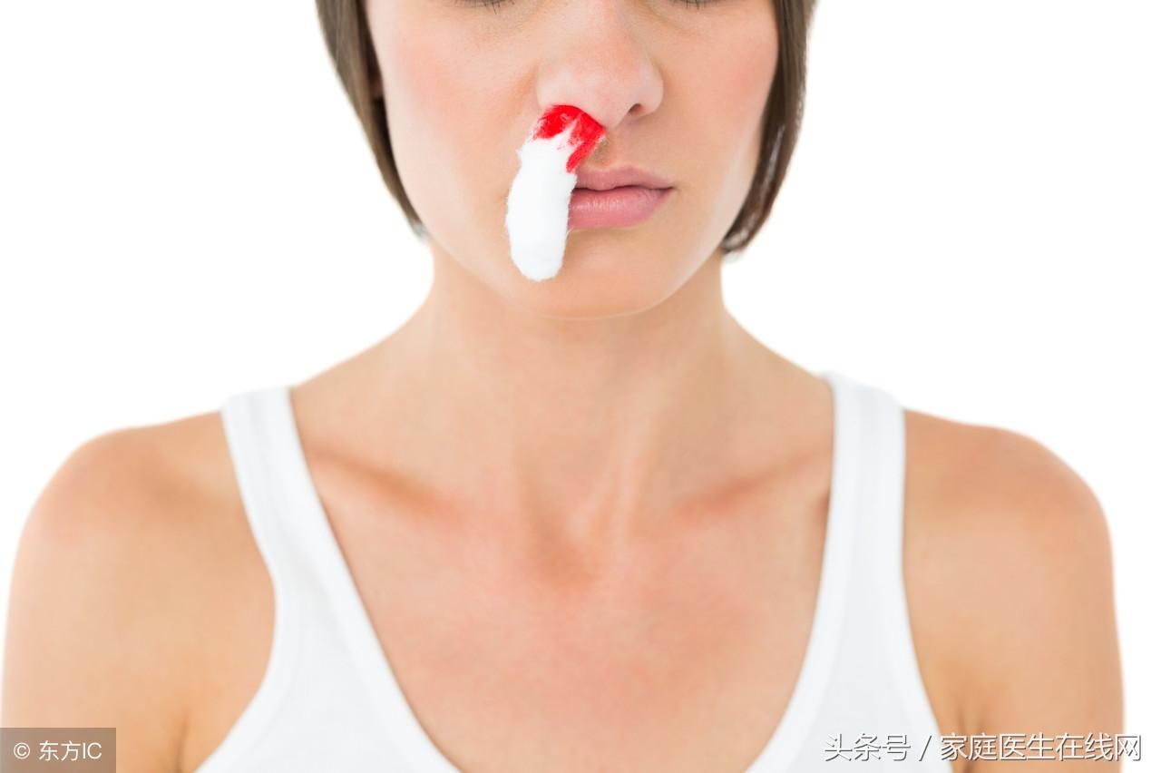 流鼻血的原因，如何预防鼻出血