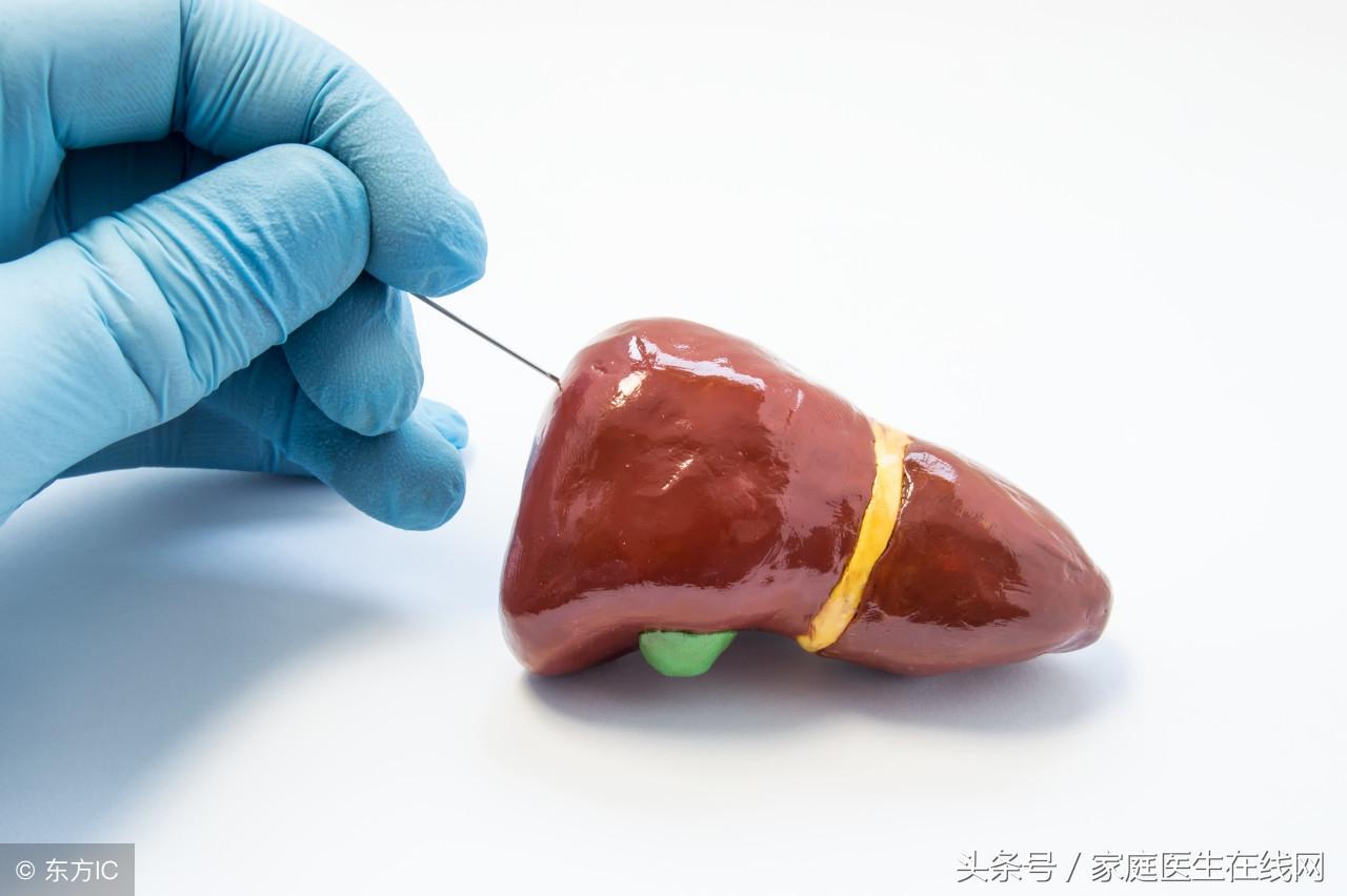 肝硬化的症状有哪些，身体会发出这3个“信号”