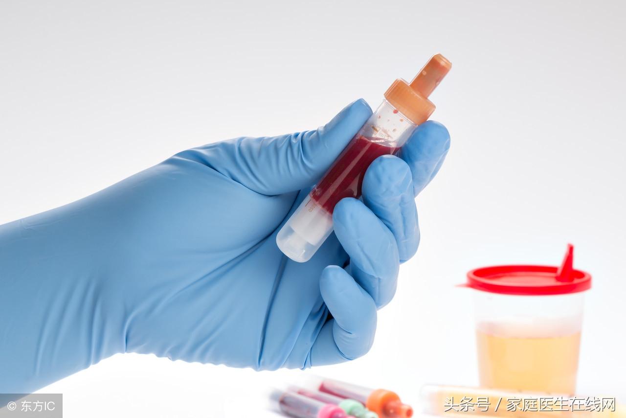 小便带血是什么原因，注意这3种情况
