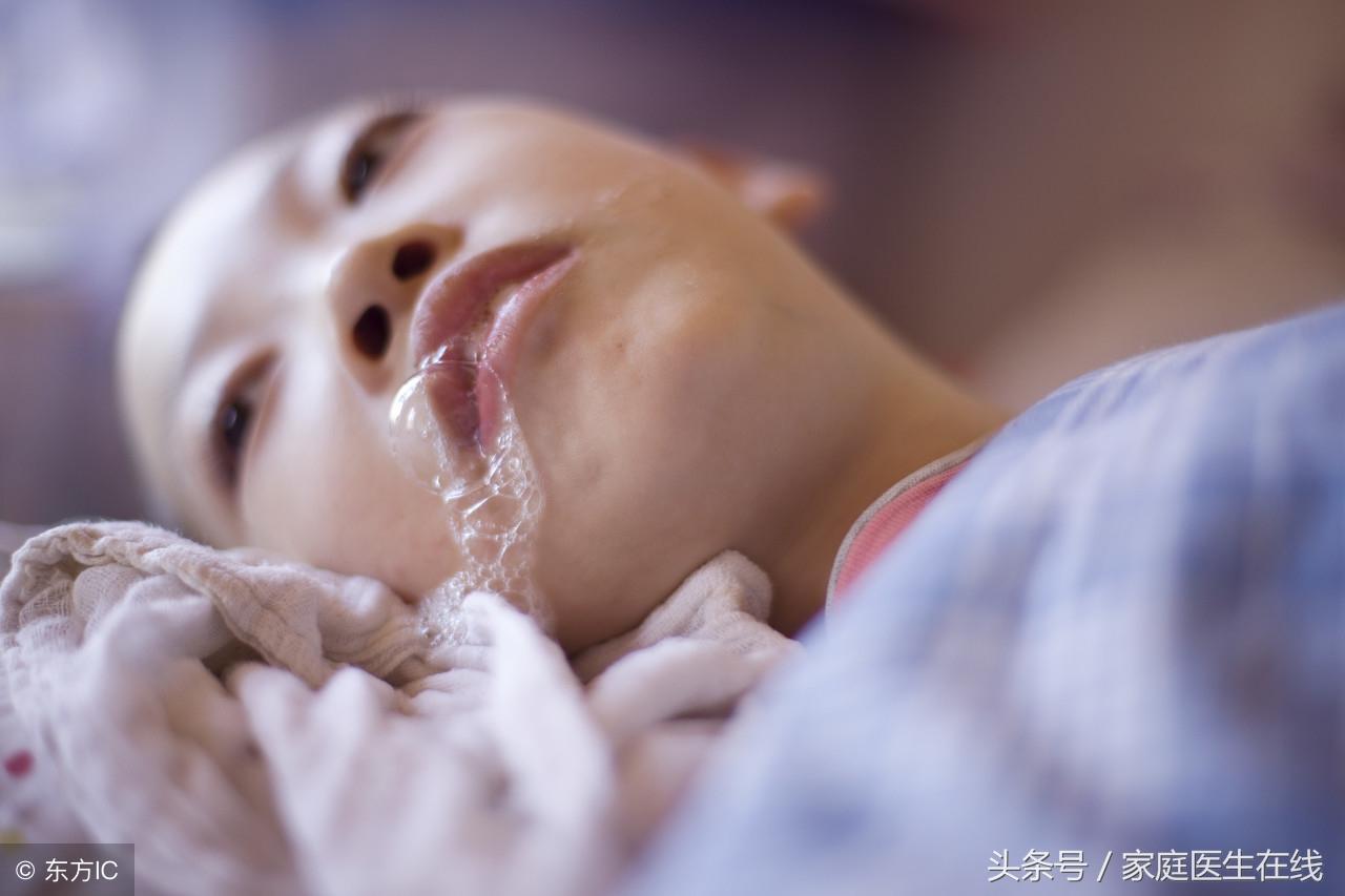 儿童癫痫病症状，会有这三个症状