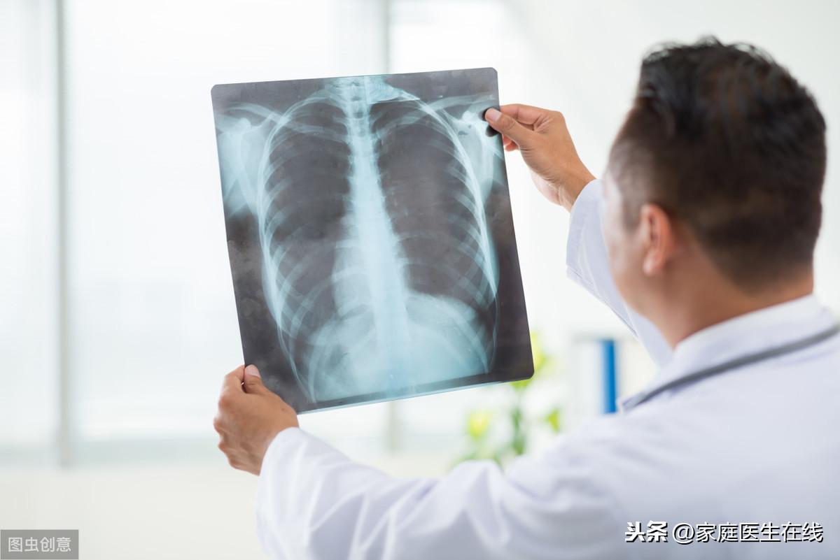 支原体肺炎症状，如何预防支原体肺炎呢？