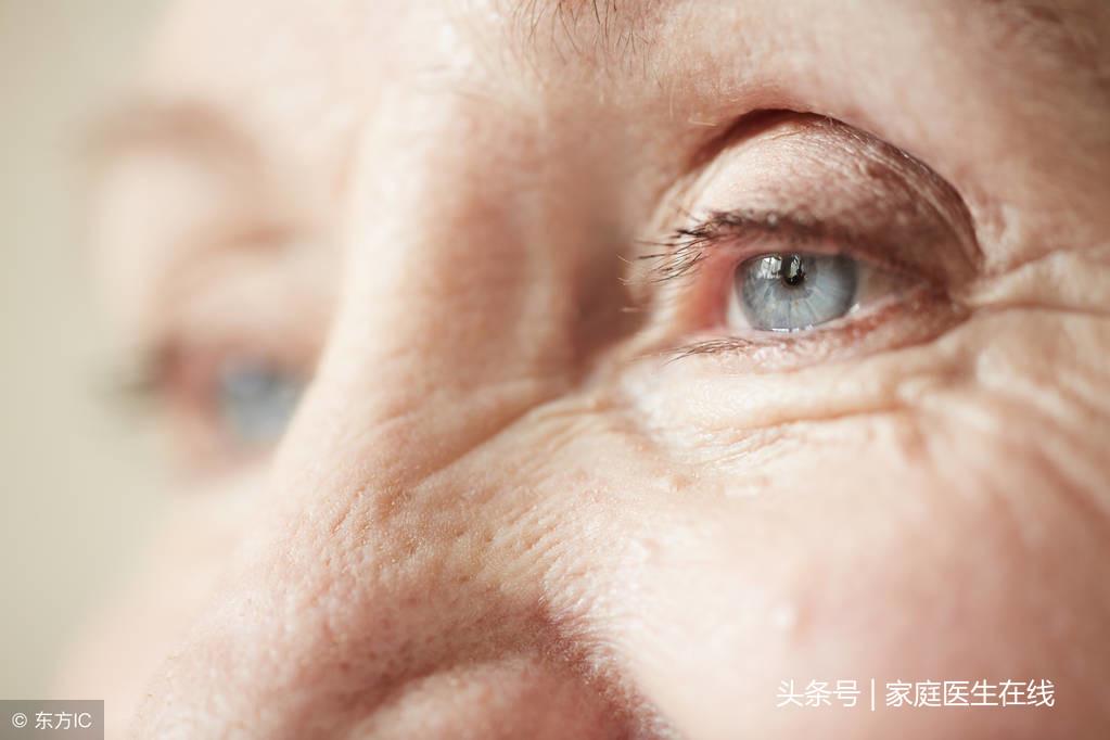 白内障形成原因，4个病因记得避开