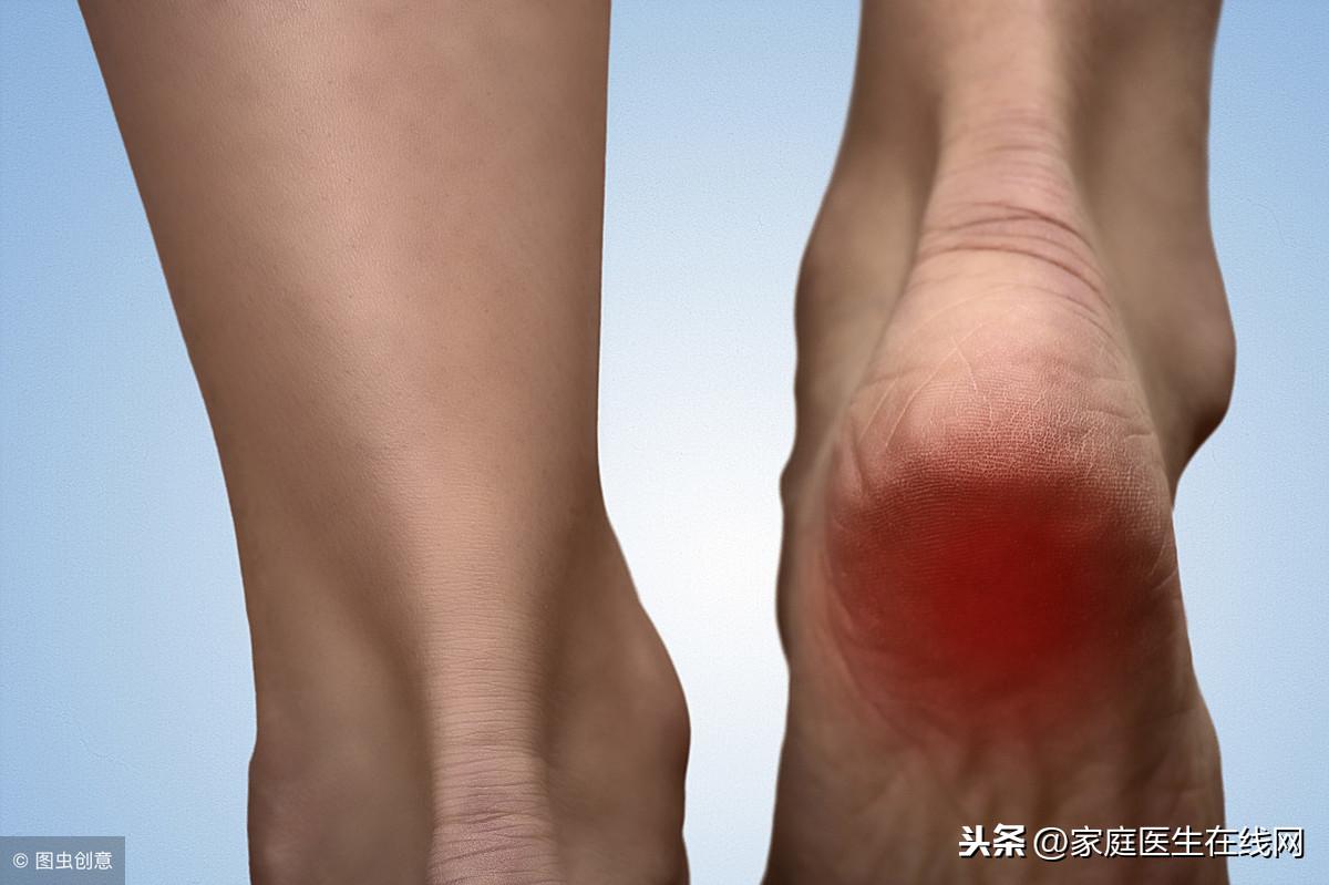 脚后跟干裂是什么原因，遇到脚后跟裂怎么办呢？