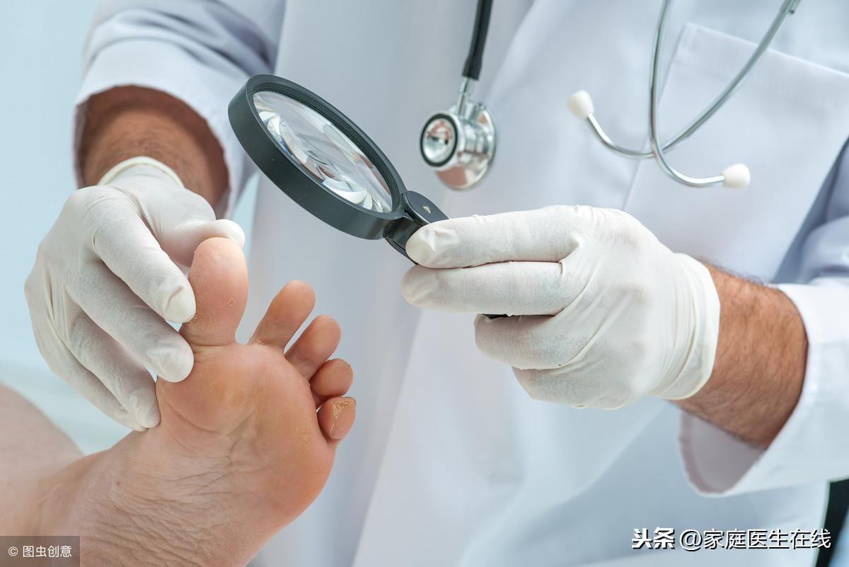 长灰指甲是什么原因，预防灰指甲的方法