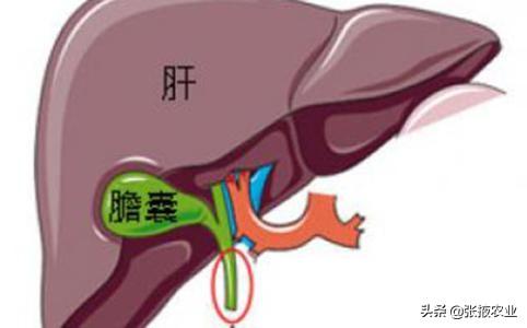 胆囊炎的症状，胆囊炎不能吃什么?