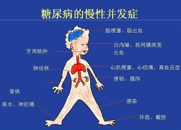 血糖高怎样调理，饮食按这3步走，远离并发症