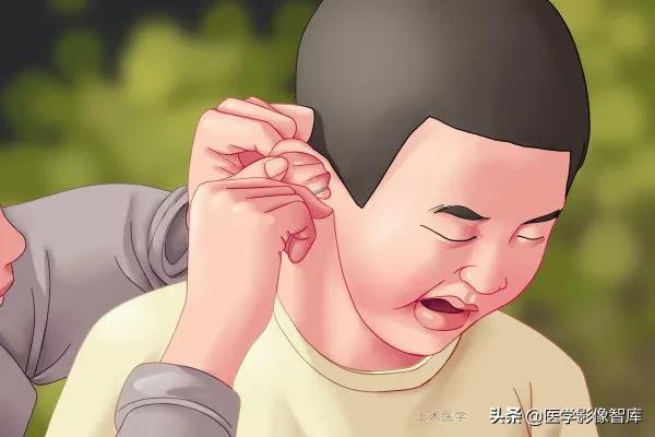 鼓膜穿孔症状和治疗措施