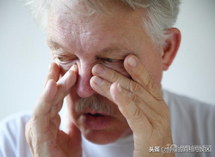 鼻癌的早期症状，这6个症状最易被忽视