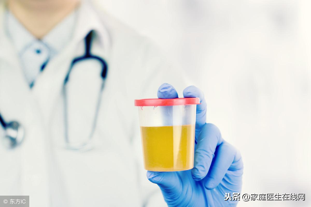 尿黄是什么原因引起的，有这7种可能性