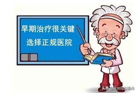 斑秃治疗方法，治疗中会出现哪些副作用